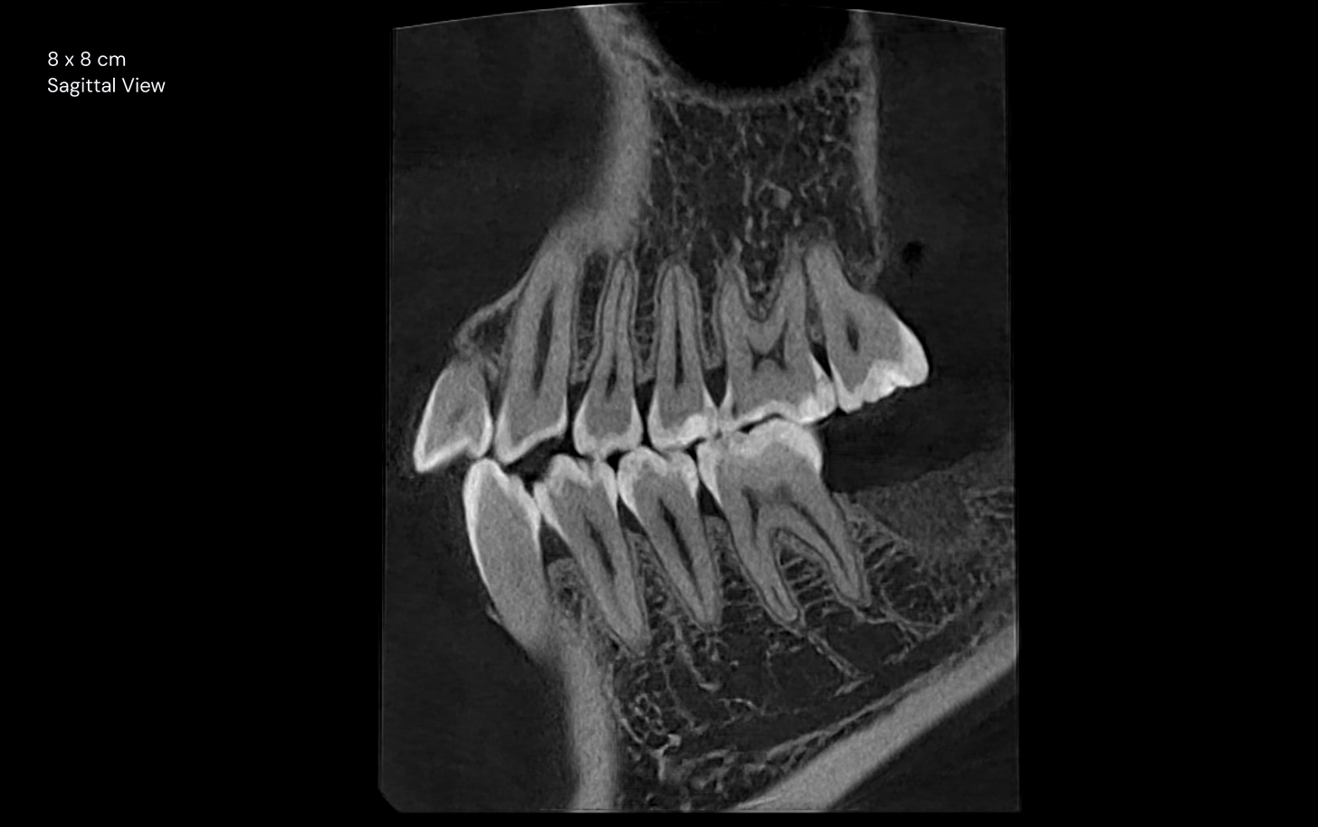 8 x 8 cm sagittal view